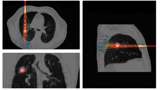 Figure 2: DoseDepositedCarbonIonBeamInCT