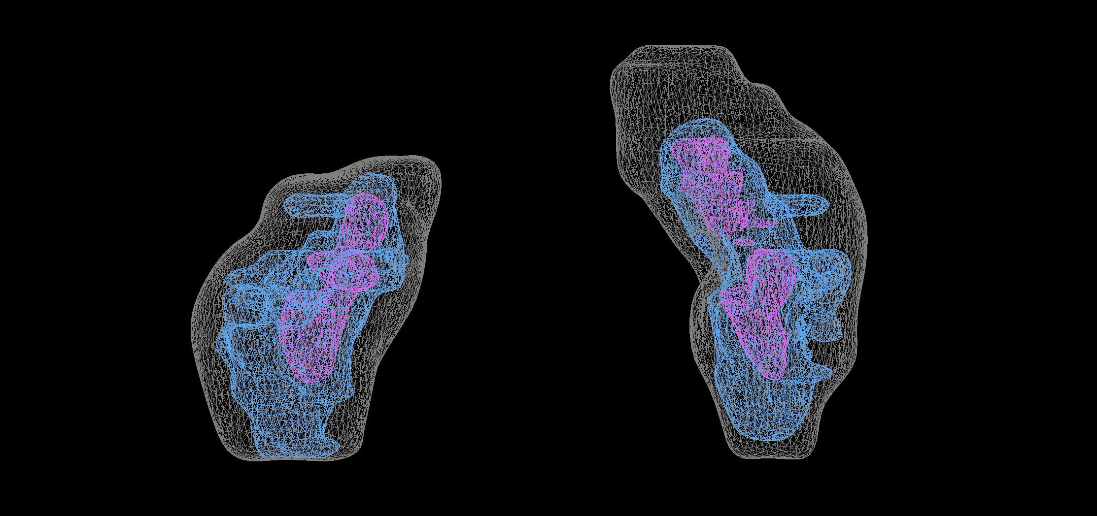 Figure 5: kidneys_STL